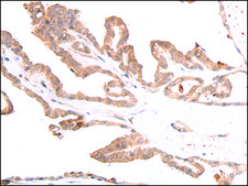 Anti-GLI3 affinity isolated antibody