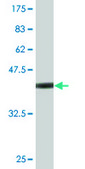 Monoclonal Anti-EXOSC8, (C-terminal) antibody produced in mouse clone 4B3, purified immunoglobulin, buffered aqueous solution