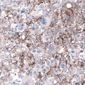Anti-CD99 antibody produced in mouse Prestige Antibodies® Powered by Atlas Antibodies, clone CL12929, purified by using Protein A, buffered aqueous glycerol solution