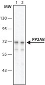 Anti-PP2A subunit B isoform B56-δ antibody, Mouse monoclonal clone H5D12, purified from hybridoma cell culture
