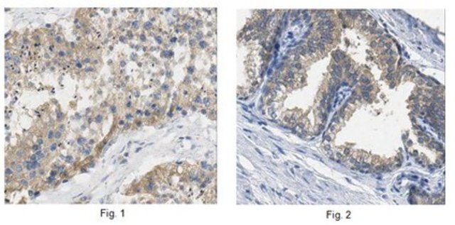 Anti-BTG3 Antibody from rabbit, purified by affinity chromatography