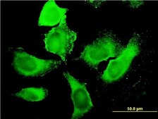 Monoclonal Anti-PIP5K3 antibody produced in mouse clone 6C7, purified immunoglobulin, buffered aqueous solution