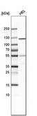 Anti-GART antibody produced in rabbit Prestige Antibodies® Powered by Atlas Antibodies, affinity isolated antibody, buffered aqueous glycerol solution