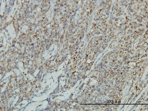 Monoclonal Anti-JUP antibody produced in mouse clone 2G9, purified immunoglobulin, buffered aqueous solution