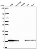 Anti-Cfl1 Antibody Produced In Rabbit Prestige Antibodies® Powered by Atlas Antibodies, affinity isolated antibody, buffered aqueous glycerol solution