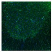 Anti-HTR3B antibody produced in rabbit affinity isolated antibody