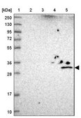 抗-UTP23 兔抗 Prestige Antibodies® Powered by Atlas Antibodies, affinity isolated antibody, buffered aqueous glycerol solution