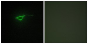 Anti-Collagen XX α1 antibody produced in rabbit affinity isolated antibody