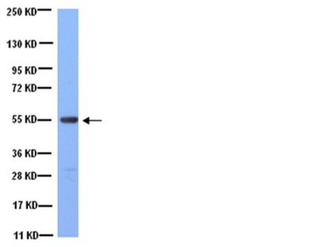 Anti-Tubulin Antibody, clone YL1/2 clone YL1/2, Chemicon&#174;, from rat