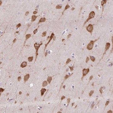 Anti-HABP4 antibody produced in rabbit Prestige Antibodies&#174; Powered by Atlas Antibodies, affinity isolated antibody, buffered aqueous glycerol solution