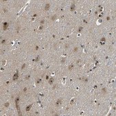 Anti-RBM28 antibody produced in rabbit Prestige Antibodies® Powered by Atlas Antibodies, affinity isolated antibody, buffered aqueous glycerol solution, Ab1