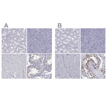 Anti-PPM1G antibody produced in rabbit Prestige Antibodies&#174; Powered by Atlas Antibodies, affinity isolated antibody, buffered aqueous glycerol solution