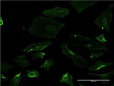 Monoclonal Anti-SPAST antibody produced in mouse clone 2F5, purified immunoglobulin, buffered aqueous solution