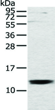 Anti-UQCRH affinity isolated antibody