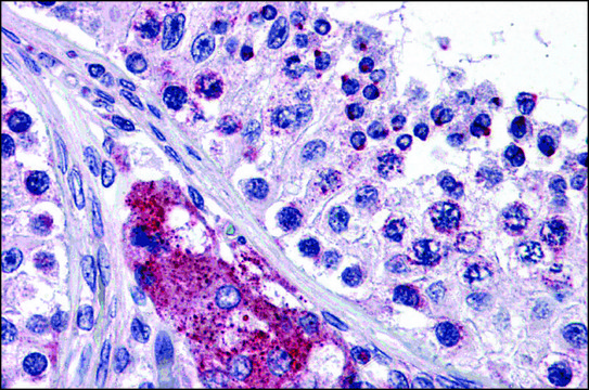 Anti-PTCHD2 antibody produced in rabbit affinity isolated antibody