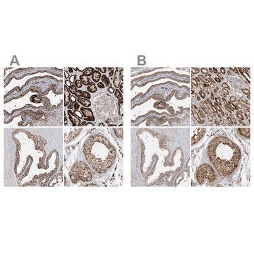 Anti-NDUFAF3 antibody produced in rabbit Prestige Antibodies&#174; Powered by Atlas Antibodies, affinity isolated antibody, buffered aqueous glycerol solution