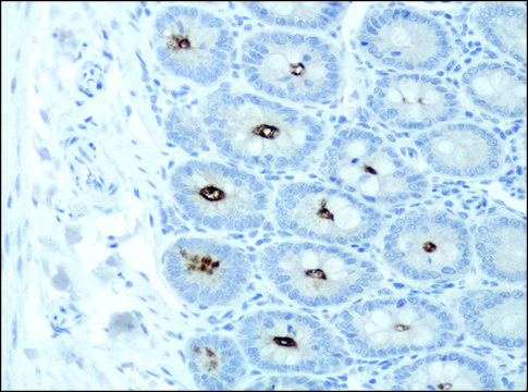 Anti-DSCR1 (C-terminal) antibody produced in rabbit ~1.5&#160;mg/mL, affinity isolated antibody, buffered aqueous solution