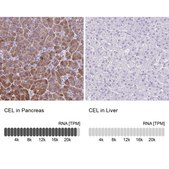 Anti-CEL antibody produced in rabbit Prestige Antibodies® Powered by Atlas Antibodies, affinity isolated antibody, buffered aqueous glycerol solution