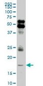 ANTI-LMO2 antibody produced in mouse clone 4D3, purified immunoglobulin, buffered aqueous solution