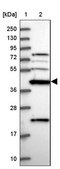 Anti-CKMT1A antibody produced in rabbit Prestige Antibodies® Powered by Atlas Antibodies, affinity isolated antibody, buffered aqueous glycerol solution