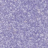 Anti-HOMER3 antibody produced in rabbit Prestige Antibodies® Powered by Atlas Antibodies, affinity isolated antibody, buffered aqueous glycerol solution