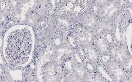 Anti-APN/CD13 Antibody, clone 1D20 ZooMAb® Rabbit Monoclonal recombinant, expressed in HEK 293 cells