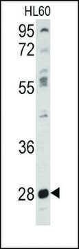 Anti-PKMYT1 (center) antibody produced in rabbit IgG fraction of antiserum, buffered aqueous solution