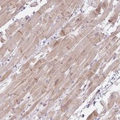 Anti-FILIP1 antibody produced in rabbit Prestige Antibodies® Powered by Atlas Antibodies, affinity isolated antibody, buffered aqueous glycerol solution