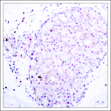 Anti-NFKB1 (Ab-907) antibody produced in rabbit affinity isolated antibody