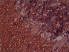 Anti-Neuron-Specific Enolase (NSE) antibody, Mouse monoclonal clone NSE-P2, purified from hybridoma cell culture