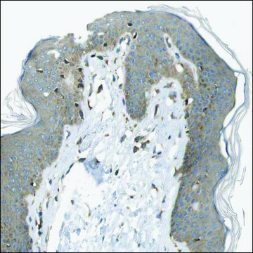 Anti-TRPM1 antibody produced in rabbit Prestige Antibodies&#174; Powered by Atlas Antibodies, affinity isolated antibody, buffered aqueous glycerol solution