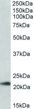 Anti-TMEM205 antibody produced in goat affinity isolated antibody, buffered aqueous solution