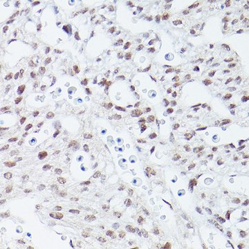 Anti-Islet1 antibody produced in rabbit