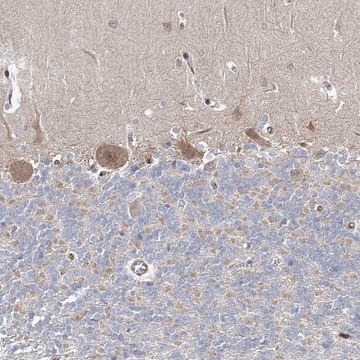 Anti-ARHGAP32 antibody produced in rabbit Prestige Antibodies&#174; Powered by Atlas Antibodies, affinity isolated antibody, buffered aqueous glycerol solution