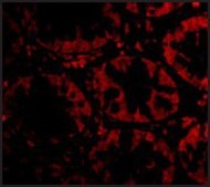 Anti-STEAP2 antibody produced in rabbit affinity isolated antibody, buffered aqueous solution