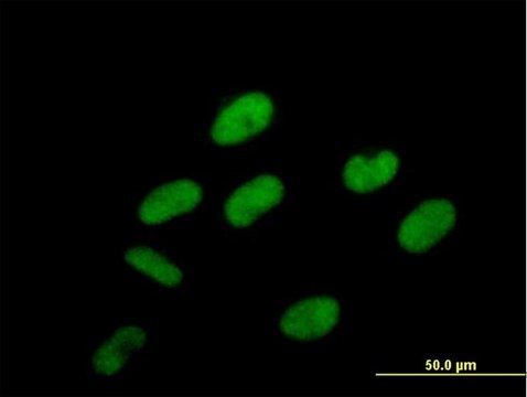 抗 PCIF1 小鼠抗 purified immunoglobulin, buffered aqueous solution