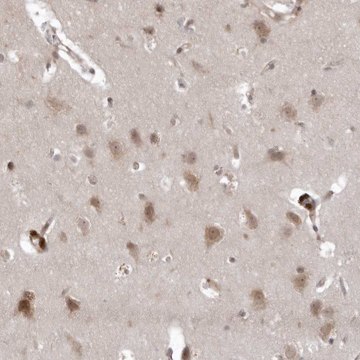 Anti-USP43 antibody produced in rabbit Prestige Antibodies&#174; Powered by Atlas Antibodies, affinity isolated antibody, buffered aqueous glycerol solution