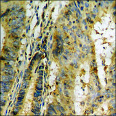 抗-磷酸化-Tau (pSer356) 兔抗 affinity isolated antibody