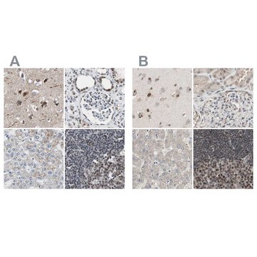 Anti-ZHX2 antibody produced in rabbit Prestige Antibodies&#174; Powered by Atlas Antibodies, affinity isolated antibody, buffered aqueous glycerol solution