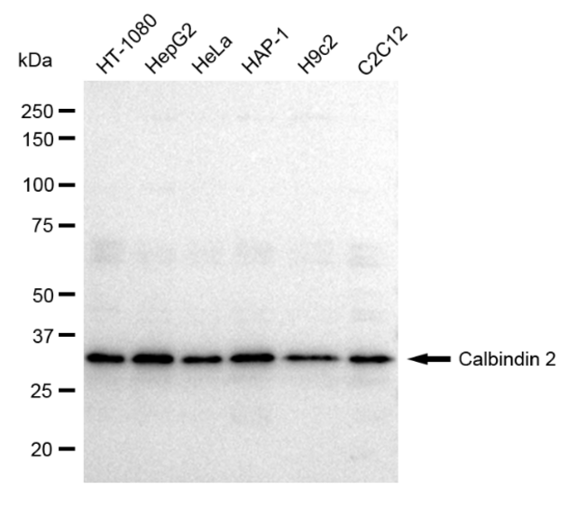 Anti Calbindin 2 Antibody, clone 23GB1125, Rabbit Monoclonal clone 23GB1125, recombinant rabbit monoclonal, expressed in HEK293 cells