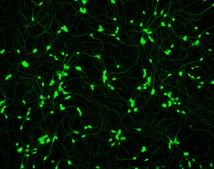 Human Spinal Motor Neurons Human iPSC line, Fully differentiated, Healthy Male Control (no known neurological disorders), Cryopreserved