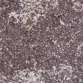 Anti-ZFX antibody produced in rabbit Prestige Antibodies® Powered by Atlas Antibodies, affinity isolated antibody, buffered aqueous glycerol solution