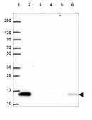 Anti-KIAA0040 antibody produced in rabbit Prestige Antibodies® Powered by Atlas Antibodies, affinity isolated antibody, buffered aqueous glycerol solution