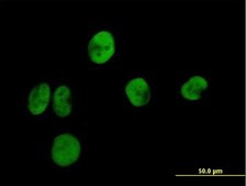 Anti-RPA2 antibody produced in mouse purified immunoglobulin, buffered aqueous solution