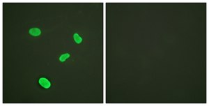Anti-Histone H4 antibody produced in rabbit affinity isolated antibody