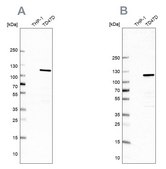 Anti-RABEP1 antibody produced in rabbit Prestige Antibodies® Powered by Atlas Antibodies, affinity isolated antibody, buffered aqueous glycerol solution, Ab1