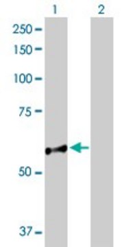 Anti-NUP98 antibody produced in rabbit purified immunoglobulin, buffered aqueous solution