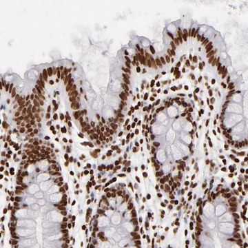 Anti-FBXO18 antibody produced in rabbit Prestige Antibodies&#174; Powered by Atlas Antibodies, affinity isolated antibody, buffered aqueous glycerol solution