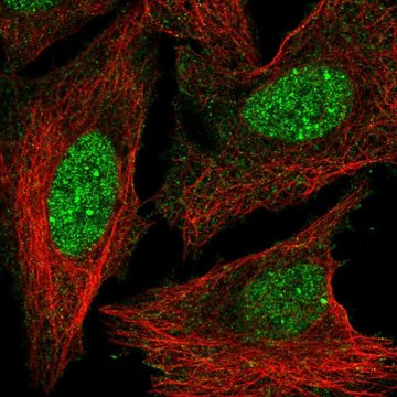 Anti-HOXD3 antibody produced in rabbit Prestige Antibodies&#174; Powered by Atlas Antibodies, affinity isolated antibody