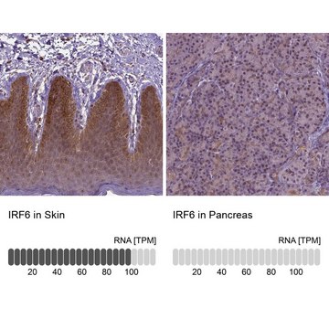 Anti-IRF6 antibody produced in rabbit Prestige Antibodies&#174; Powered by Atlas Antibodies, affinity isolated antibody, buffered aqueous glycerol solution